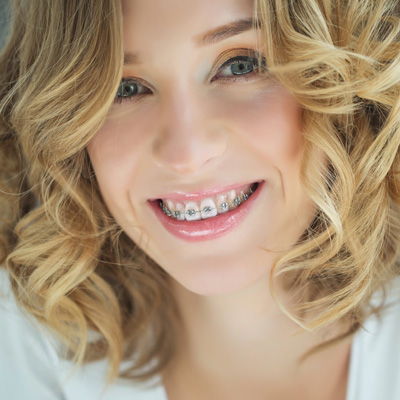 A woman with straight teeth wearing braces is smiling at the camera.