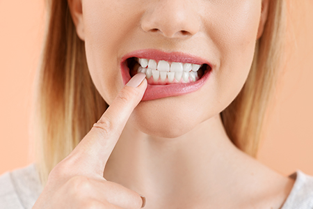 A woman with her finger on her teeth, making an expression of surprise or disbelief.